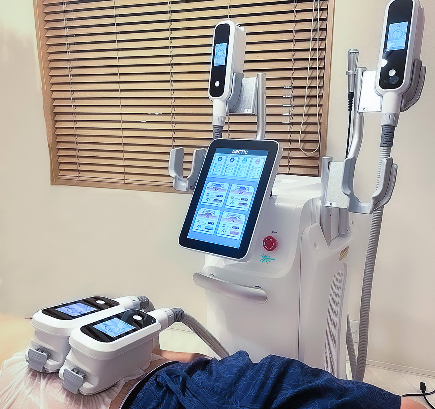 RAYTONE Cryolipolysis CoolSculpting Body Contouring Equipment