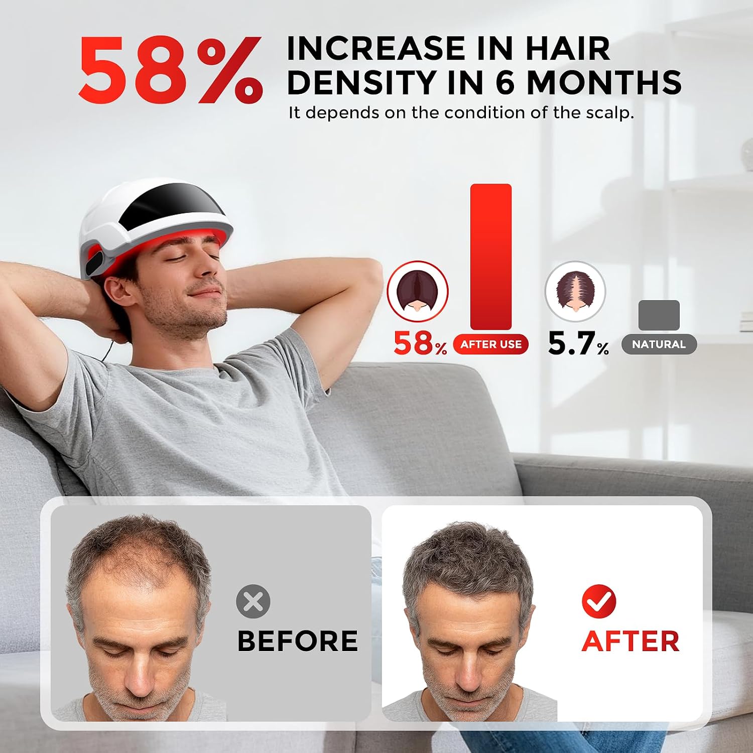 RAYTONE ReGen LIGHT – Ultra Light Hair Restoration Helmet