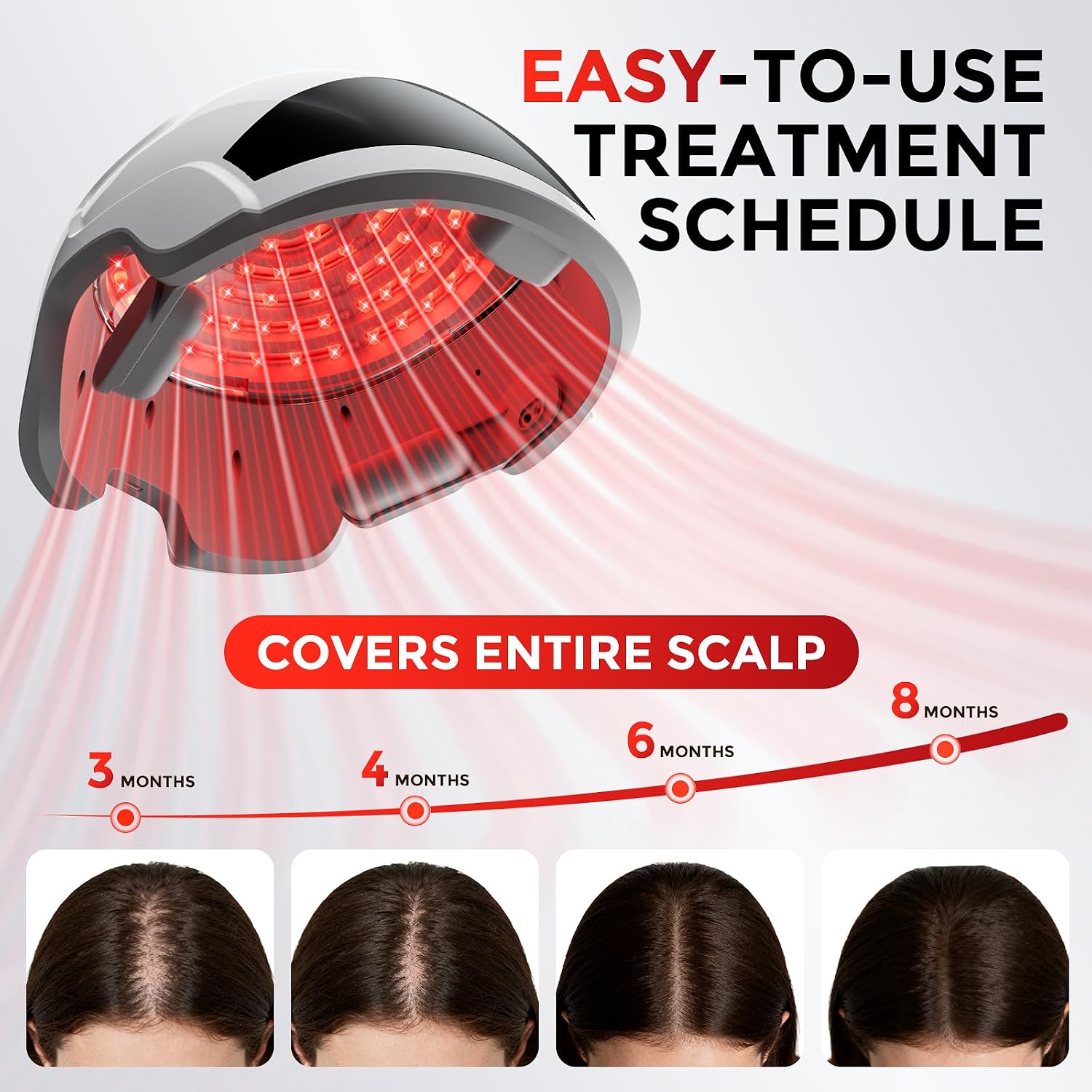 RAYTONE ReGen LIGHT – Ultra Light Hair Restoration Helmet
