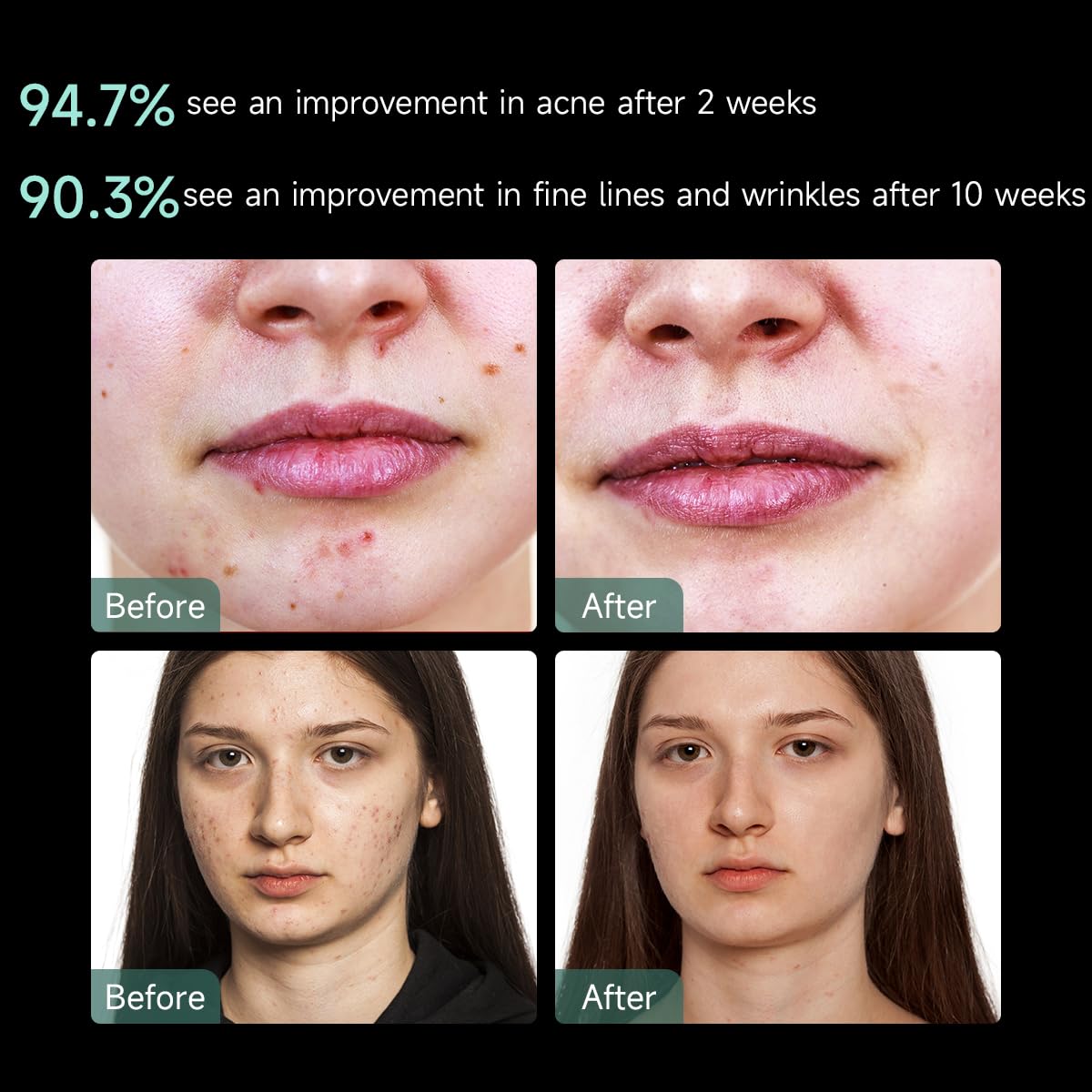 RAYTONE LUXIR+ LED Light Therapy Mask | New Generation LED Light Therapy Facial & Neck Mask